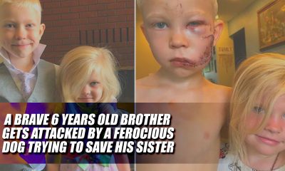 A Brave 6 Years Old Brother Gets Attacked by a Ferocious Dog Trying to Save Sister