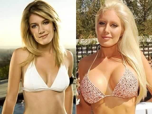 heidi montag plastic surgery 2022