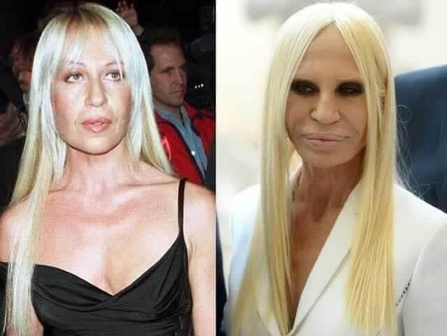 How Donatella Versace transformed herself into a human waxwork